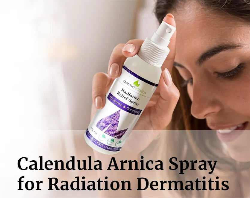 Soothe Skin with Calendula Arnica Spray for Radiation Dermatitis