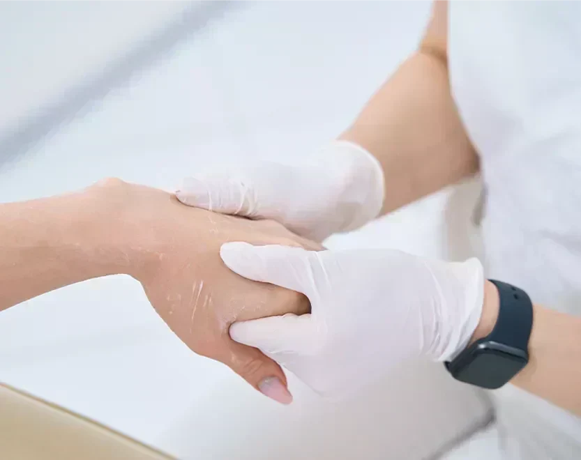 Nursing Tips for Managing Hand-Foot Syndrome During Chemotherapy