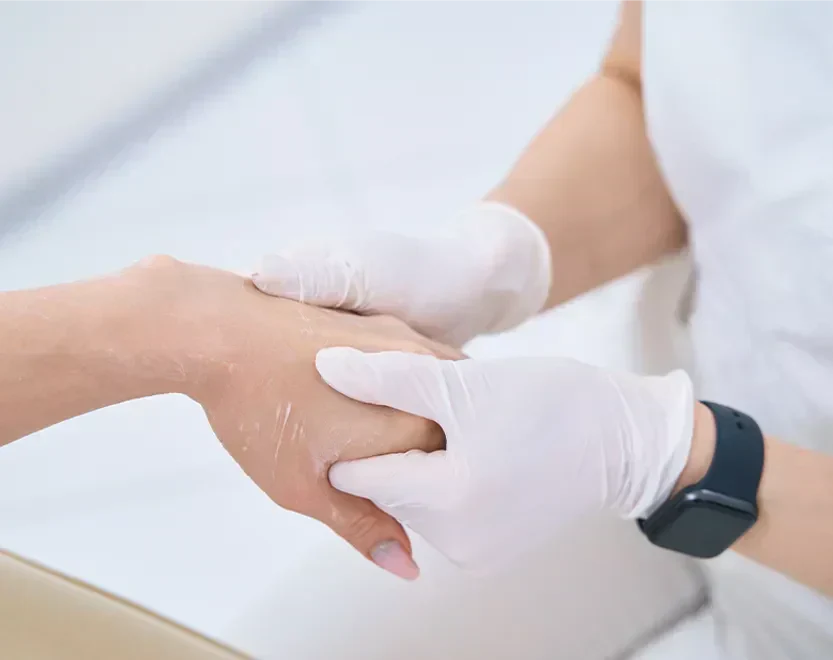 Nursing Tips for Managing Hand-Foot Syndrome During Chemotherapy