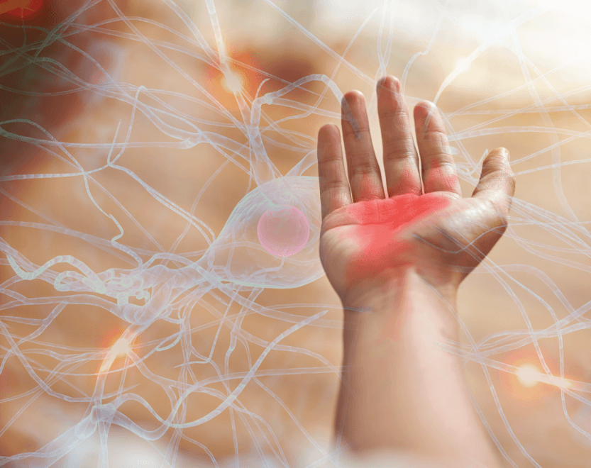 Management of Chemotherapy Induced Neuropathy - Dermavitality
