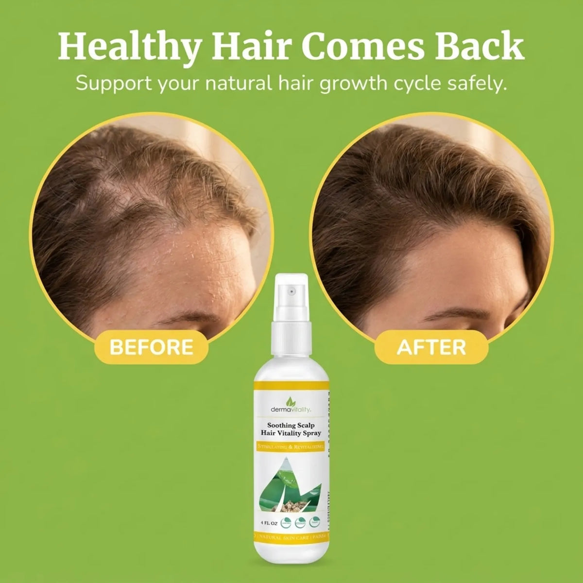 Dermavitality Soothing Scalp Hair Vitality Spray shown with before-and-after hair images, highlighting support for the natural hair growth cycle and fuller-looking hair.